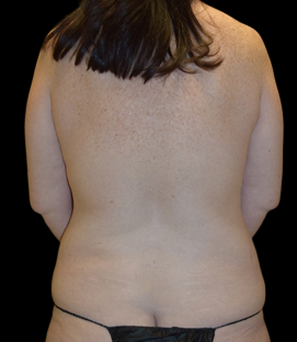 Before - Back