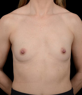 Before - DR43