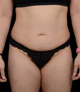 Before - DR47